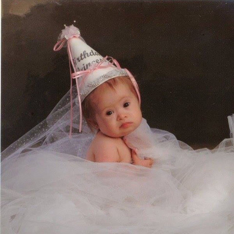 One doctor advised mum Renee that she give Kennedy up for adoption when she was born